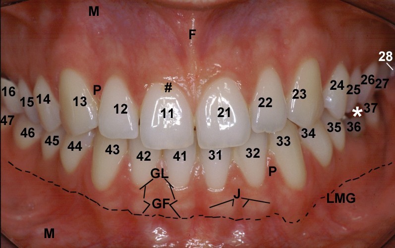 labelled image of human teeth - clinical anatomy